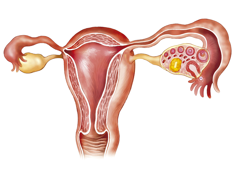 喝中药后小腹胀痛竟是子宫肌瘤患者的好现象？