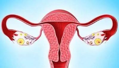 广州治疗卵巢癌中医专家:女性卵巢癌的症状和危害又该预防呢