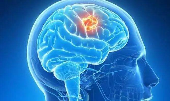 患上脑瘤对人体会产生哪些危害？主要有这3种